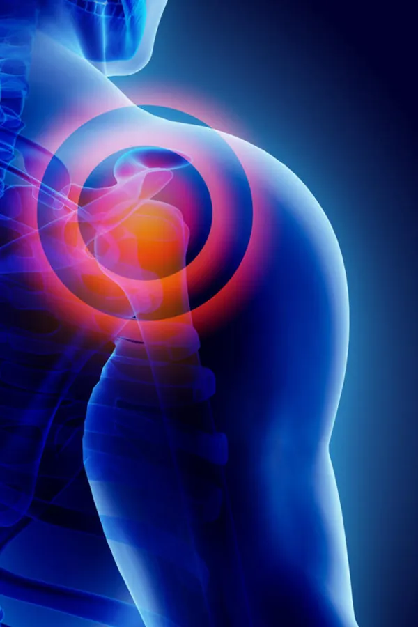 PRP-for-Shoulder-Injury-Treatment A 3D image of a transparent human shoulder, with red radiating circles representing shoulder pain, which can be relieved by PRP treatment for shoulder pain from Pierre Rojas, DO in South Lyon.