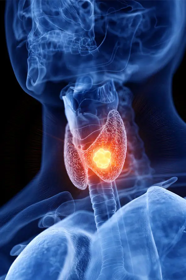 Thyroid-Imbalance-Treatment A 3D illustration of an x-ray of a human neck, highlighting the thyroid. Get help with thyroid imbalance from Pierre Rojas, DO in South Lyon.